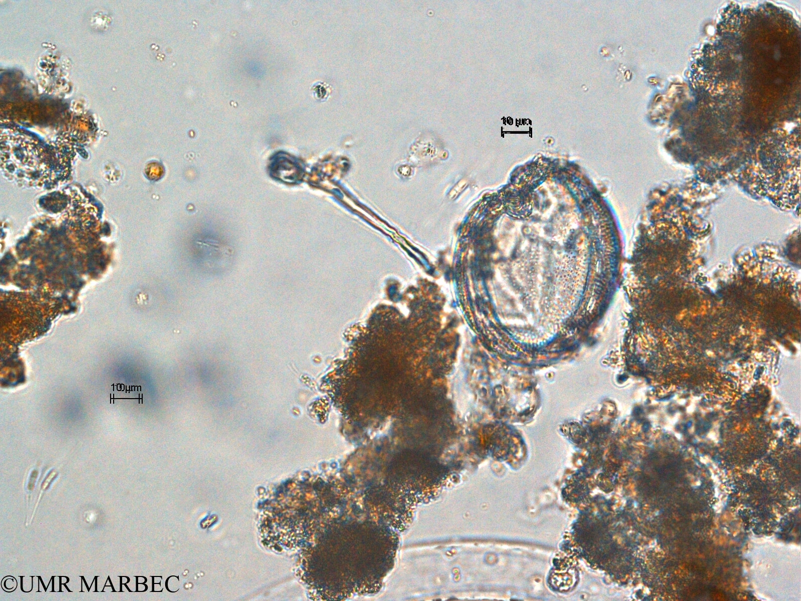 phyto/Scattered_Islands/europa/COMMA April 2011/Diplopsalid 4 (ancien Taxon Oblea-Gotoius 1 > Gotoius sp recomposé)(copy).jpg
